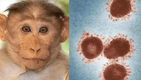 猴痘是什么？猴痘是什么病有什么症状