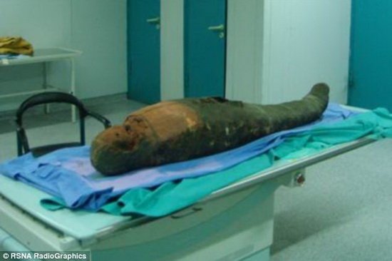 科学家发现千年木乃伊头颅中残留的取脑棒