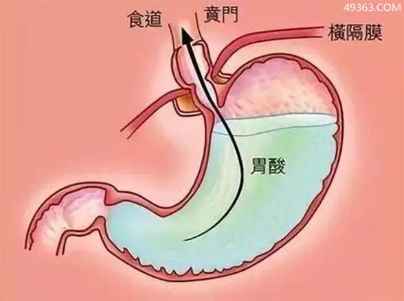 胃在的正确位置图