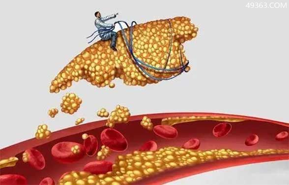总胆固醇高说明什么