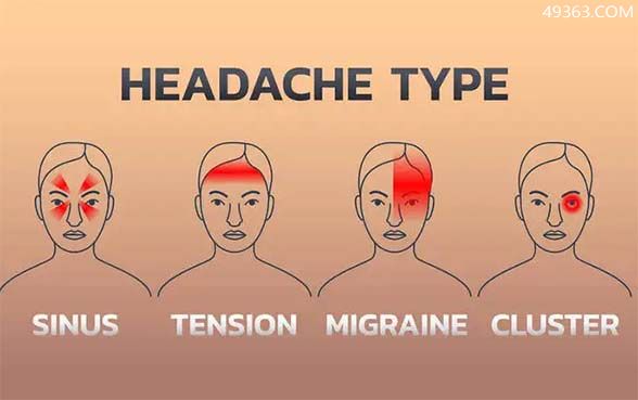 怎样判断自己的头痛类型