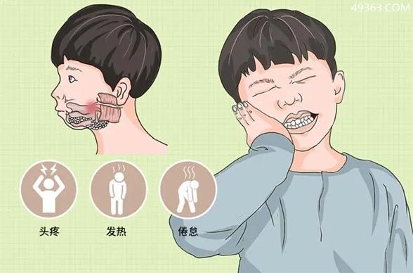 腮腺炎的症状有哪些