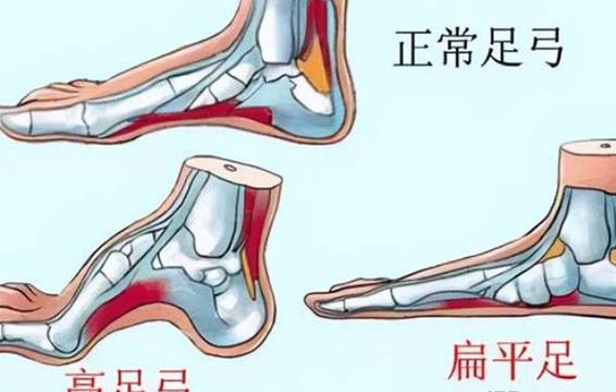 脚的各个部位详细图