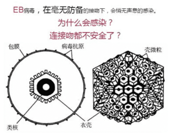 eb病毒是什么意思